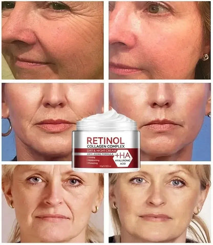 Retinol Wrinkle Removing Cream Anti Aging Firming Lifting Fade Fine